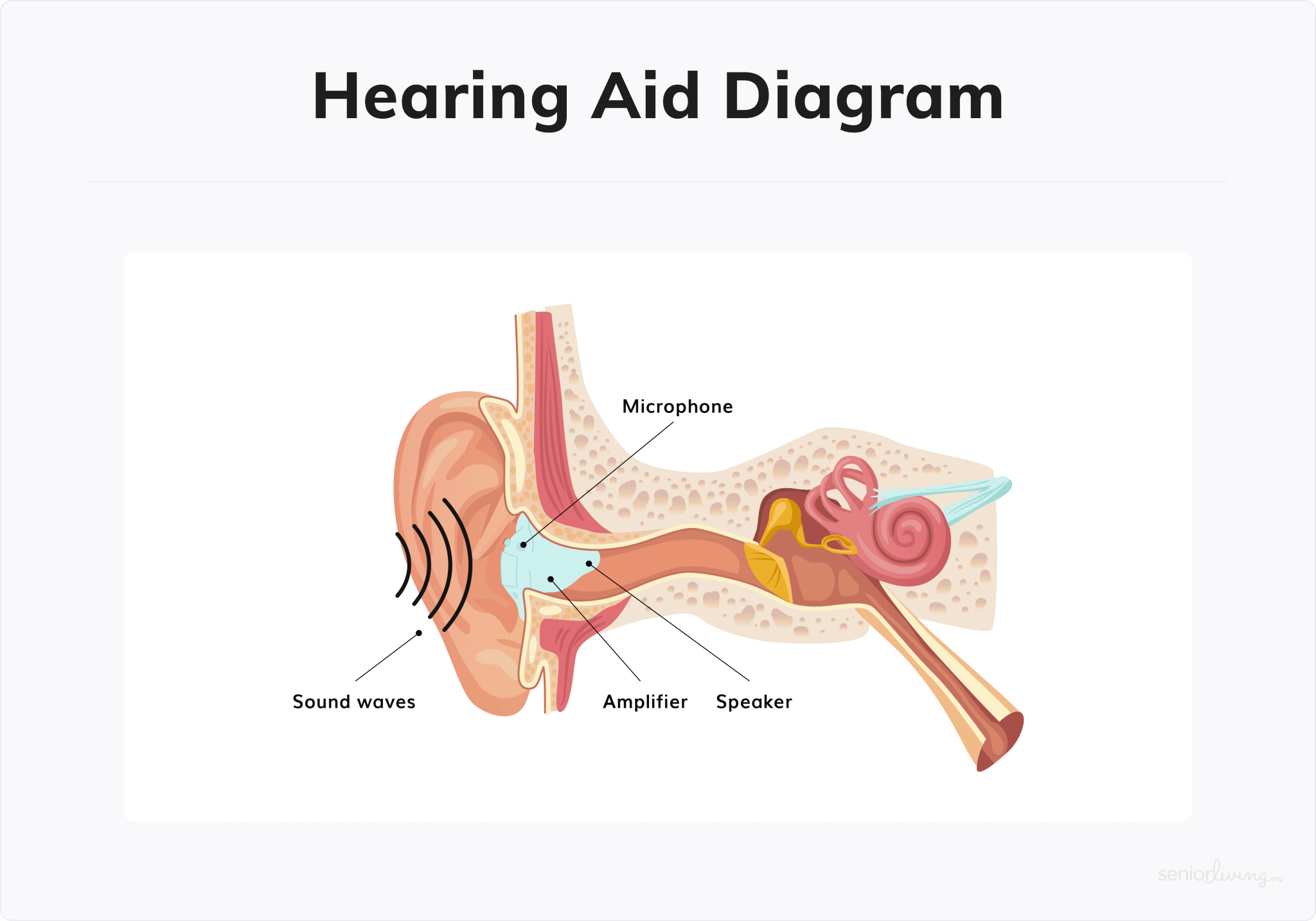 Hearing Loss – Binaural Hearing and Speech Lab – UW–Madison